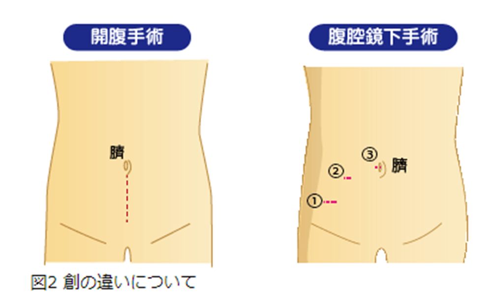 創の違い