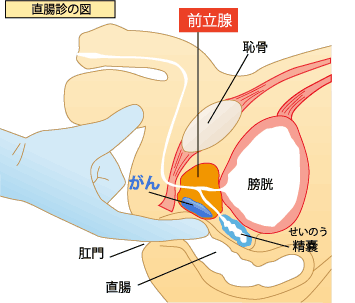 直腸