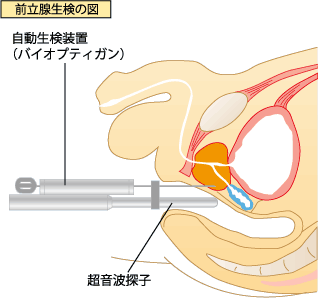 前立腺